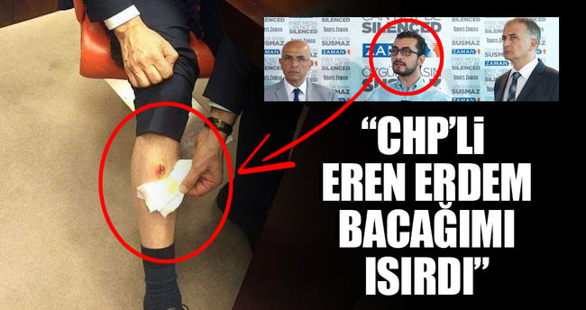 CHP'li Eren Erdem AK Partili vekili bacağından ısırdı!..