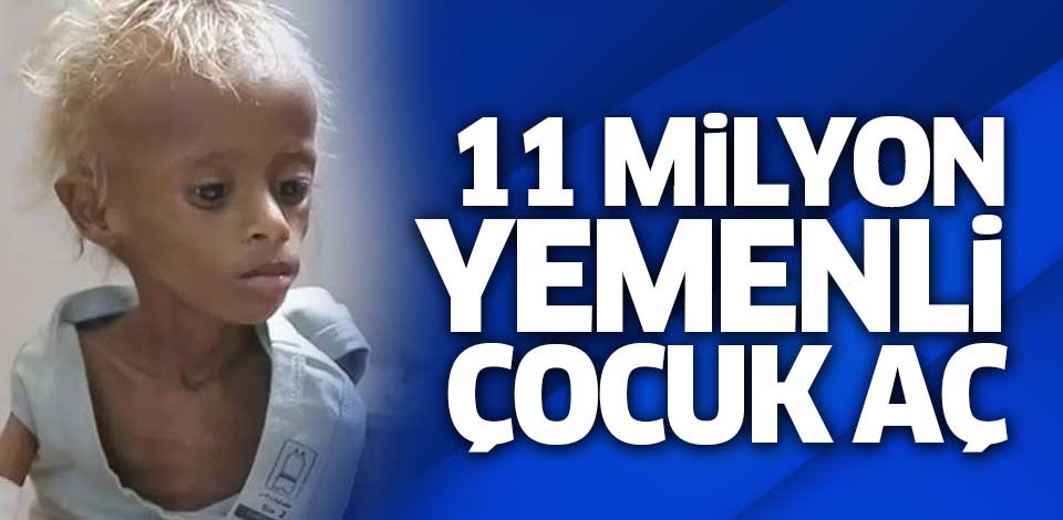 Yemen'de 11 milyon çocuk aç!..