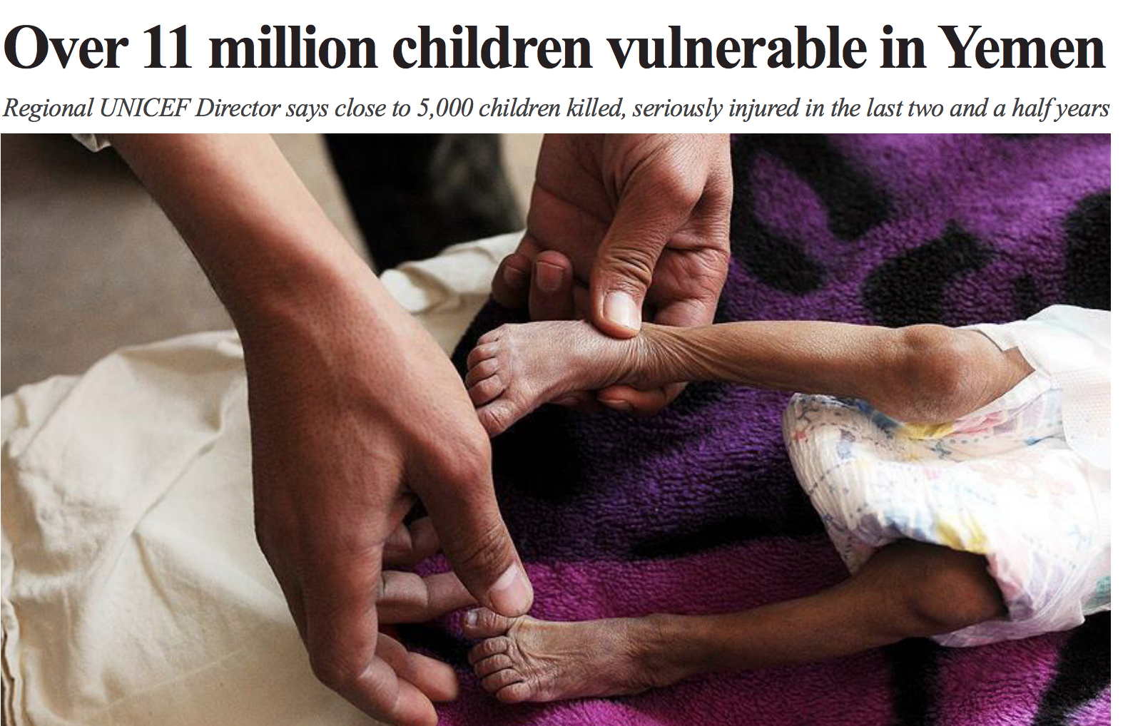 Over 11 million children vulnerable in Yemen: UNICEF