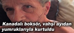Kanadalı boksör vahşi ayıdan yumruklarıyla kurtuldu..