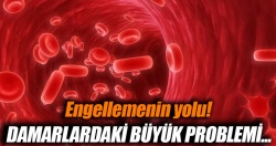 Damar tıkanıklığını önleyen 10 besin..