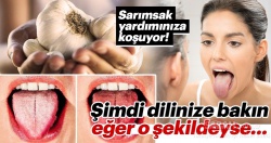 Dilinizi temizlemeyi ihmal etmeyin..