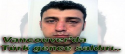 Vancouver'da Türk gence saldırı!..