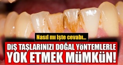 Diş taşları için doğal yöntemler...