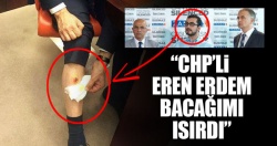 CHP'li Eren Erdem AK Partili vekili bacağından ısırdı!..