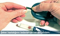 Şeker hastalığının tedavisinde cerrahi yöntem