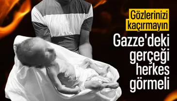 Gazze'deki gerçeği herkes görmeli!