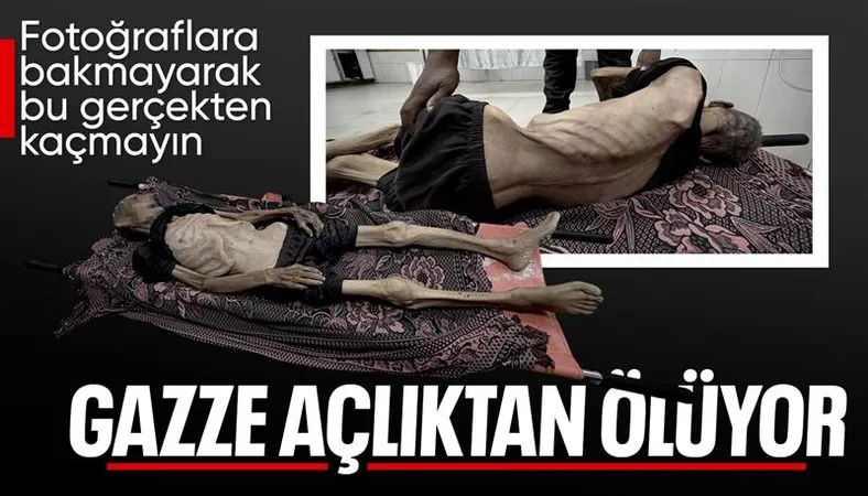 Gazze'de açlık can almaya devam ediyor!